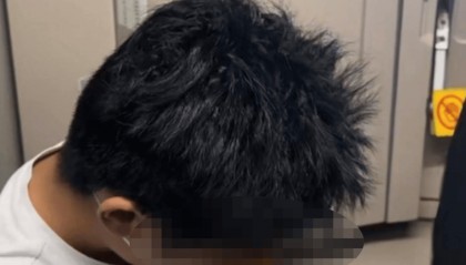 19岁少年飞机上突发剧烈头痛和面部麻木,医生万米高空针灸施救,婉拒家属红包